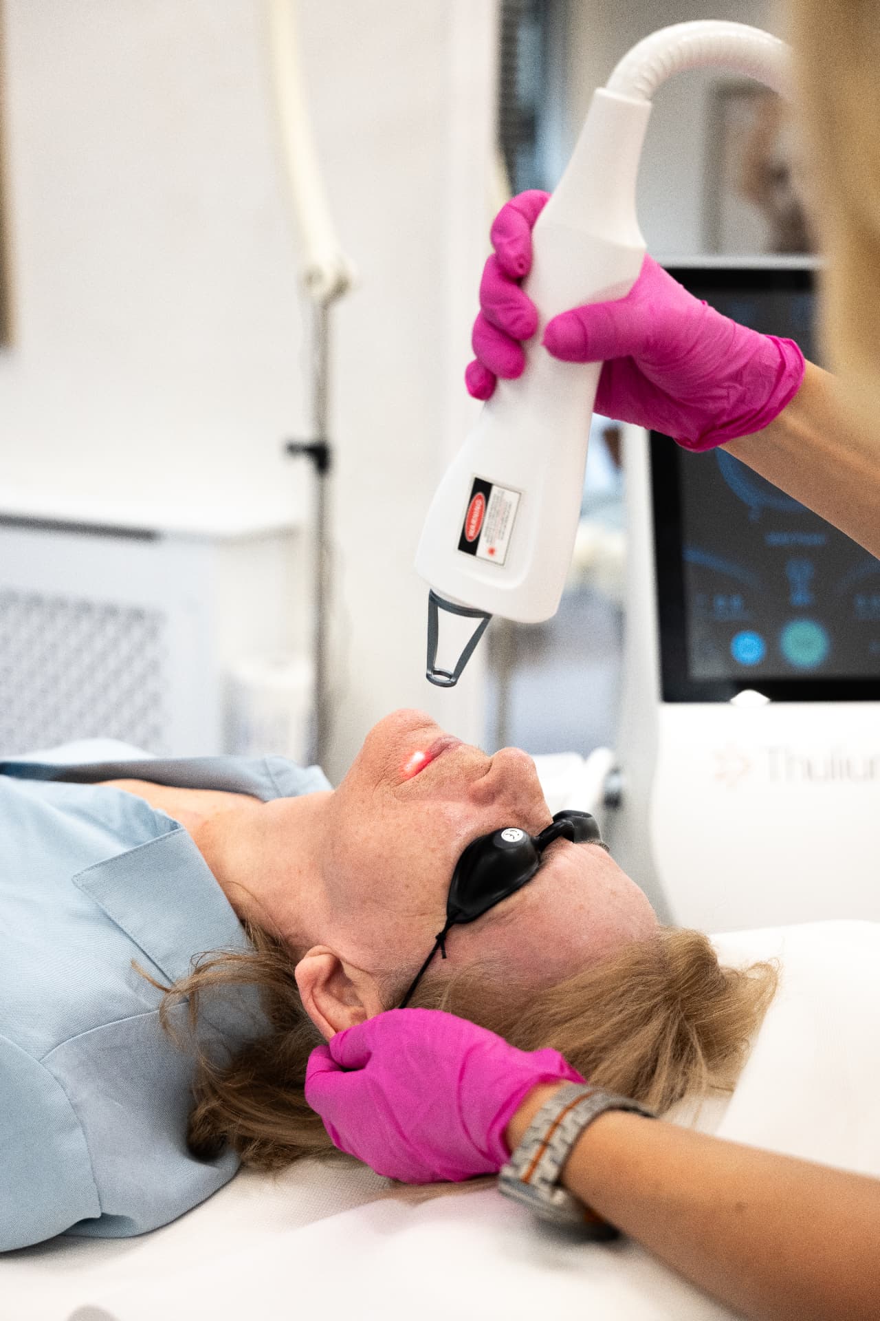 Laser Thulium — zabieg na skórę twarzy